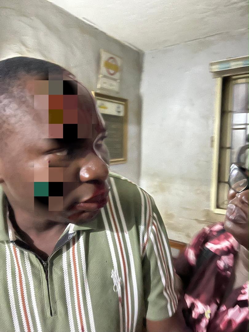 Patient’s relative stabs laboratory scientist at Ogun Federal Medical Centre
